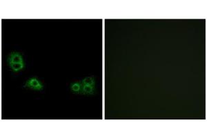 Immunofluorescence analysis of MCF-7 cells, using TMEM185A antibody. (TMEM185A anticorps  (C-Term))