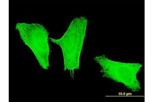 Immunofluorescence of monoclonal antibody to PIK3CG on HeLa cell.