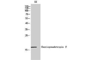 Western Blotting (WB) image for anti-Chorionic Gonadotropin, beta Polypeptide (CGB) (C-Term) antibody (ABIN3183911) (CGB anticorps  (C-Term))