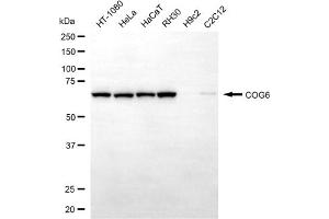 Western blotting analysis using COG6 antibody (ABIN7798144).