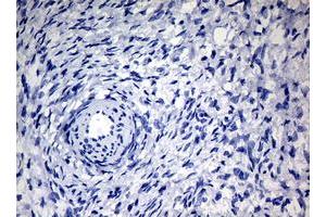 Image no. 5 for anti-Nibrin (NBN) (AA 461-754) antibody (ABIN1491540)