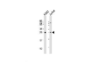 Western Blot at 1:2000 dilution Lane 1: K562 whole cell lysates Lane 2: Jurkat whole cell lysates Lysates/proteins at 20 ug per lane.