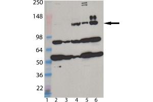 Western blot analysis of MDA5 monoclonal antibody (1B6) : Lane 1: MW marker, Lane 2: HeLa, Lane 3: A431, Lane 4: L929, Lane 5: 3T3, Lane 6: Jurkat cell lysate. (IFIH1 anticorps  (AA 78-555))