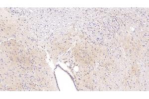 Detection of APC in Rat Cerebrum Tissue using Polyclonal Antibody to Adenomatosis Polyposis Coli Protein (APC)