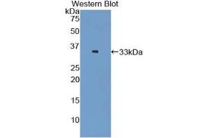Detection of Recombinant LOX1, Mouse using Polyclonal Antibody to Lectin Like Oxidized Low Density Lipoprotein Receptor 1 (LOX1) (OLR1 anticorps  (AA 60-312))