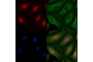 ABIN6257122 and ABIN6273438 staining  cells by IF/ICC.