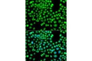 Immunofluorescence analysis of A549 cells using GOPC antibody (ABIN5975587).