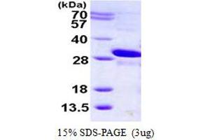 SDS-PAGE (SDS) image for Muscle RAS Oncogene Homolog (MRAS) (AA 1-205) protein (His tag) (ABIN667993) (MRAS Protein (AA 1-205) (His tag))