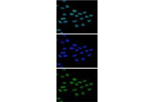 anti-Lysine (K)-Specific Demethylase 4B (KDM4B) (Internal Region) antibody