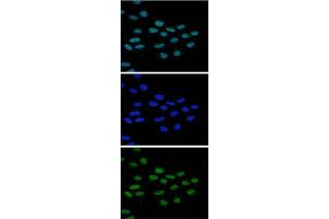 Immunofluorescence Microscopy of anti-JMJD2b antibody Immunofluorescence Microscopy results of Rabbit anti-JMJD2b antibody. (KDM4B anticorps  (Internal Region))