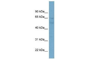 WB Suggested Anti-ZNF671  Antibody Titration: 0. (ZNF671 anticorps  (N-Term))