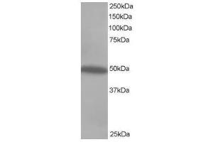 Image no. 1 for anti-C-Src tyrosine Kinase (CSK) (C-Term) antibody (ABIN374096) (CSK anticorps  (C-Term))