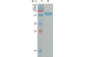 Human I Protein, hFc Tag on SDS-PAGE under reducing condition.