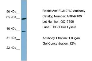 WB Suggested Anti-FLJ10769  Antibody Titration: 0. (FLJ10769 (Middle Region) anticorps)