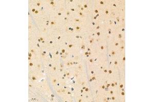 Immunohistochemistry of paraffin embedded mouse brain using PHF10 (ABIN7075029) at dilution of 1:1200 (400x lens)