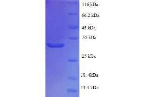 SDS-PAGE (SDS) image for TAF12 RNA Polymerase II, TATA Box Binding Protein (TBP)-Associated Factor, 20kDa (TAF12) (AA 1-161), (full length) protein (His-SUMO Tag) (ABIN5711345)