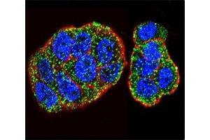 Confocal immunofluorescent analysis of KRAS antibody with WiDr cells followed by Alexa Fluor 488-conjugated goat anti-rabbit lgG (green).