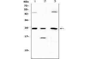 Western blot analysis of TIMP4 using anti-TIMP4 antibody (ABIN5518879). (TIMP4 anticorps  (AA 174-224))