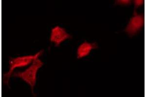 ABIN6269100 staining 293 by IF/ICC.