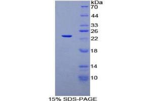 SDS-PAGE analysis of Rat SIT1 Protein.