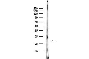 anti-MYC Associated Factor X (MAX) (N-Term) antibody