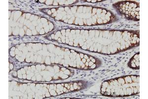anti-WNK Lysine Deficient Protein Kinase 2 (WNK2) (AA 2118-2217) antibody