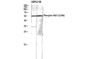 Western Blotting (WB) image for anti-V-Akt Murine Thymoma Viral Oncogene Homolog 1 (AKT1) (pSer246) antibody (ABIN3179383) (AKT1 anticorps  (pSer246))