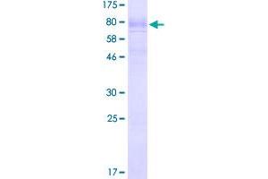 Image no. 1 for Solute Carrier Family 1 (Glial High Affinity Glutamate Transporter), Member 3 (SLC1A3) (AA 1-542) protein (GST tag) (ABIN1320176)