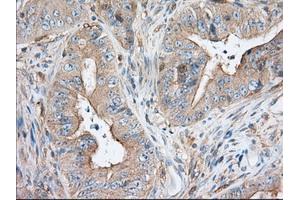 Immunohistochemical staining of paraffin-embedded Human pancreas tissue using anti-SNX9 mouse monoclonal antibody. (SNX9 anticorps)