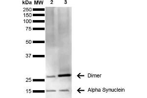 Western Blot analysis of Human Brain showing detection of 14 kDa Alpha Synuclein protein using Mouse Anti-Alpha Synuclein Monoclonal Antibody, Clone 3C11 (ABIN5564063). (SNCA anticorps  (APC))