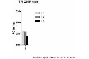 Image no. 3 for anti-Thyroid Hormone Receptor, beta (THRB) (N-Term) antibody (ABIN501627) (THRB anticorps  (N-Term))