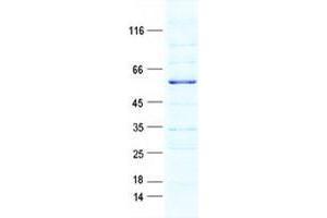 Validation with Western Blot