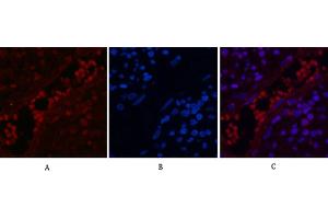 Immunofluorescence analysis of human appendix tissue. (NF-kB p65 anticorps  (acLys310))