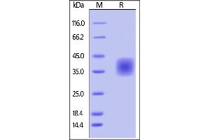 Biotinylated Human CD47, His Tag on SDS-PAGE under reducing (R) condition.