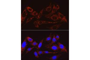 anti-Mitochondrial Ribosomal Protein S15 (MRPS15) antibody