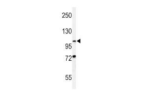 Western blot analysis of HIF1A Antibody (N-term) (ABIN650972 and ABIN2840017) in CHO cell line lysates (35 μg/lane).