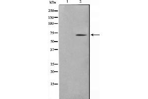 Western blot analysis on NIH-3T3 cell lysate using TGFR2 Antibody,The lane on the left is treated with the antigen-specific peptide. (TGFBR2 anticorps  (Internal Region))