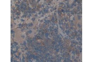 Used in DAB staining on fromalin fixed paraffin- embedded spleen tissue