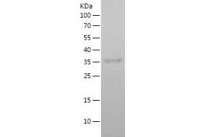 Western Blotting (WB) image for Neuroglobin (NGB) (AA 1-151) protein (His-IF2DI Tag) (ABIN7124150)