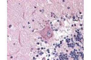Immunohistochemistry (IHC) image for anti-MAD2 Mitotic Arrest Deficient-Like 2 (MAD2L2) (AA 3-14) antibody (ABIN2470249) (MAD2L2 anticorps  (AA 3-14))
