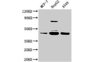Western Blot Positive WB detected in: MCF-7 whole cell lysate, HepG2 whole cell lysate, A549 whole cell lysate All lanes: SERPINB1 antibody at 2 μg/mL Secondary Goat polyclonal to rabbit IgG at 1/50000 dilution Predicted band size: 43, 27 kDa Observed band size: 43 kDa (SERPINB1 anticorps  (AA 1-379))