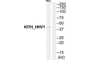 Western blot analysis of extracts from HeLa cells, using Thymidine kinase antibody. (TK1 anticorps  (Internal Region))