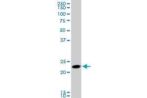 RAB11A monoclonal antibody (M01), clone 1F7-2A8.