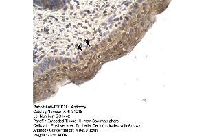 Human Spermatophore (TFCP2L1 anticorps  (N-Term))