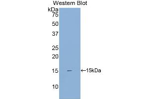 Western blot analysis of the recombinant protein. (SIGIRR anticorps  (AA 1-118))