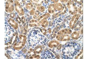 Image no. 1 for anti-Enolase 3 (Beta, Muscle) (ENO3) (N-Term) antibody (ABIN321399)