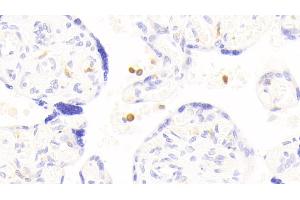 Detection of APBB1IP in Human Placenta Tissue using Polyclonal Antibody to Amyloid Beta Precursor Protein Binding B1 Interacting Protein (APBB1IP)