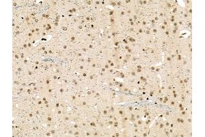 Phospho-NMDAR2A (Ser1155) Antibody at 1/100 staining Mouse brain tissue by IHC-P. (NMDAR2A anticorps  (pSer1155))