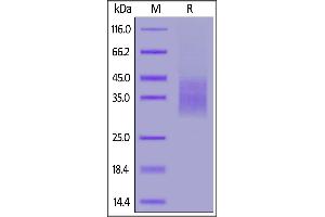 Biotinylated Cynomolgus PD-1, His,Avitag on  under reducing (R) condition.