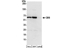 Western Blotting (WB) image for anti-Cystathionine-beta-Synthase (CBS) (AA 1-50) antibody (ABIN7453425)